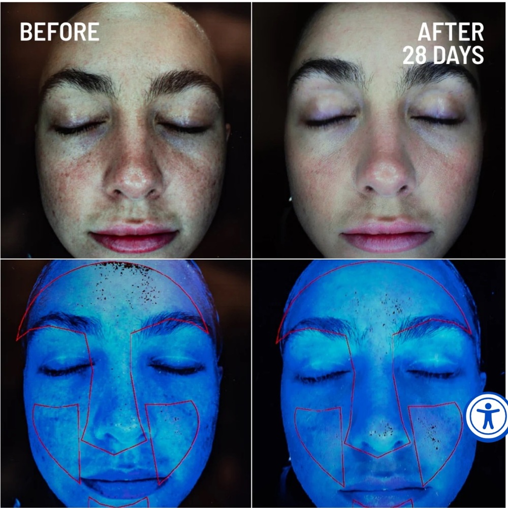 DR.BRANDT Micro dermabrasion - Picture 2 of 4